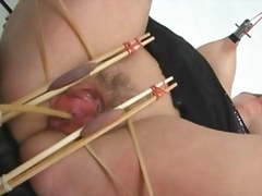Catheter insertion